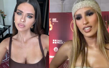 Jimena Barón confesó la peor secuela en su cara por abandonar un retoque estético