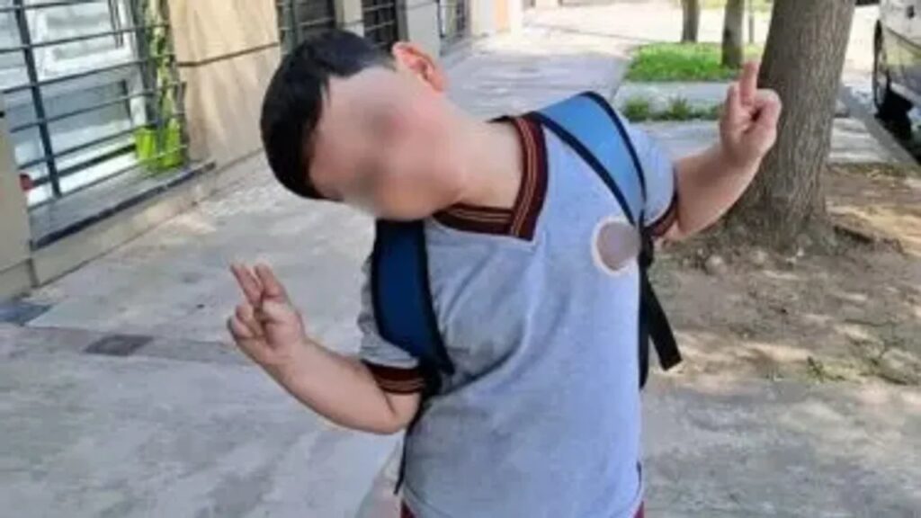 Bastián fue operado por quinta vez y se espera su evolución