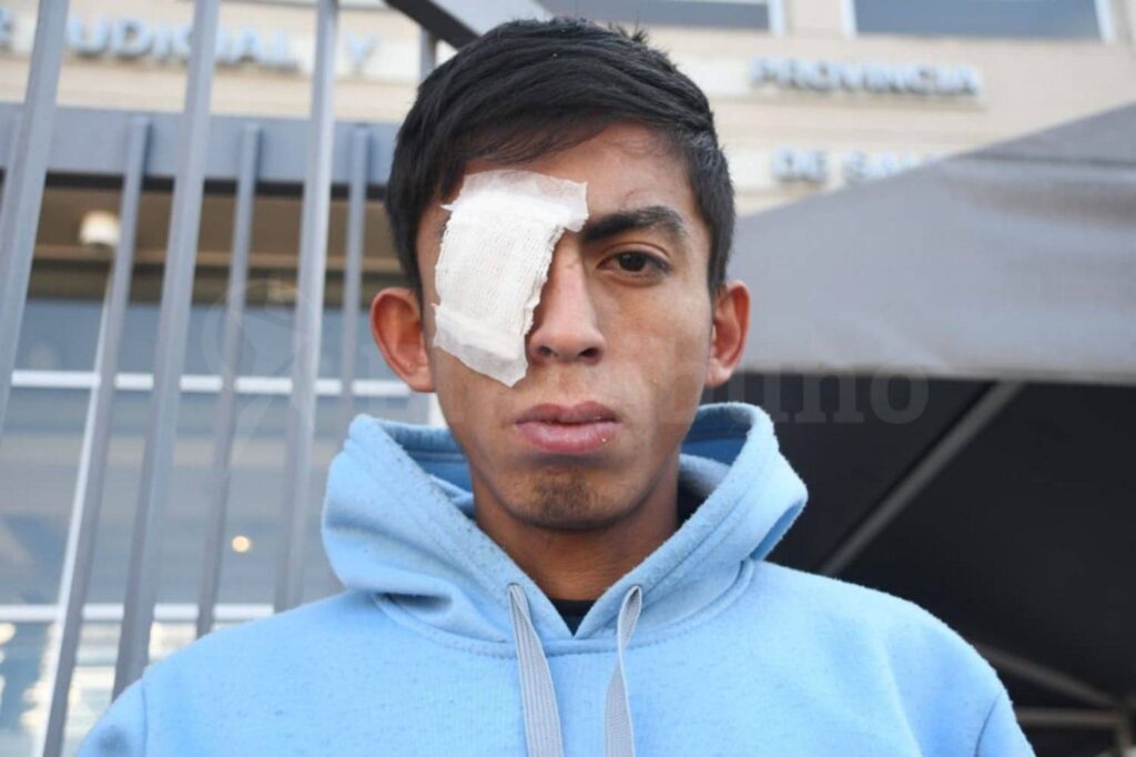 Barrio Solidaridad: un joven podría perder el ojo tras un disparo y su padre exige que la policía se haga responsable