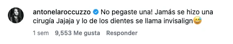 De la polémica en Instagram al secreto de su nueva imagen: qué es el "Invisalign", el único tratamiento de Leo Messi que confirmó Antonela Roccuzzo
